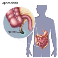 appendix of de blinde darm wordt gebruikt voor het afweersysteem van een mens en is dus niet rudimentair